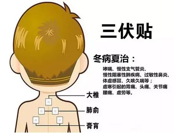 2、三伏貼的功能和功效是什么？
